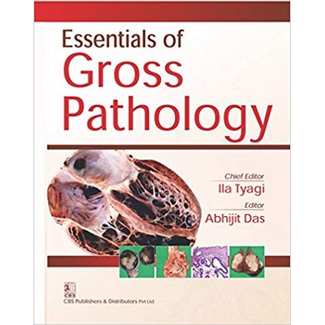 Essentials Of Gross Pathology Paperback – 16 Nov 2017by Tyagi (Author)