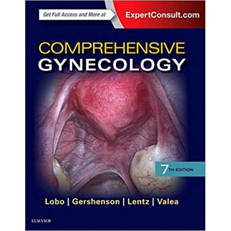 Comprehensive Gynecology Hardcover-3 Sep 2016by Rogerio A. Lobo MD (Author), David M Gershenson MD (Author), Gretchen M Lentz MD (Author)