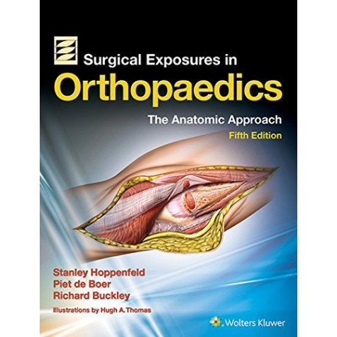 Surgical Exposures in Orthopaedics: The Anatomic Approach Hardcover-Import, 1 Jun 2009by Stanley Hoppenfeld  (Author), Piet Deboer (Author), Richard Buckley (Author)