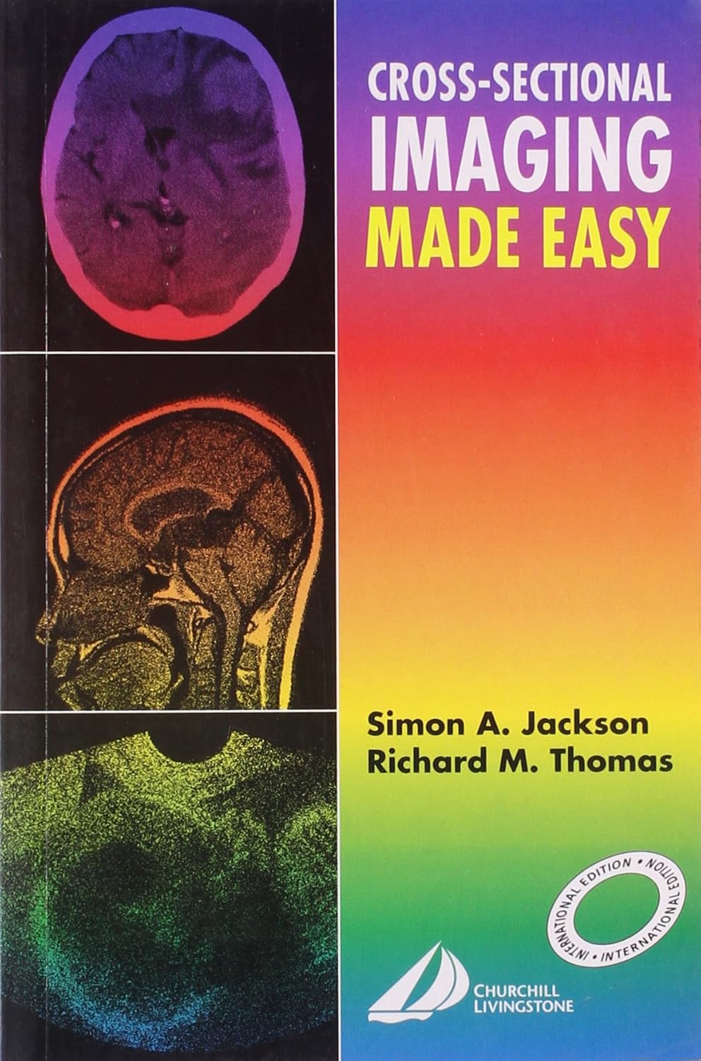 CROSS-SECTIONAL IMAGING MADE EASY (IE) by Simon A. Jackson 