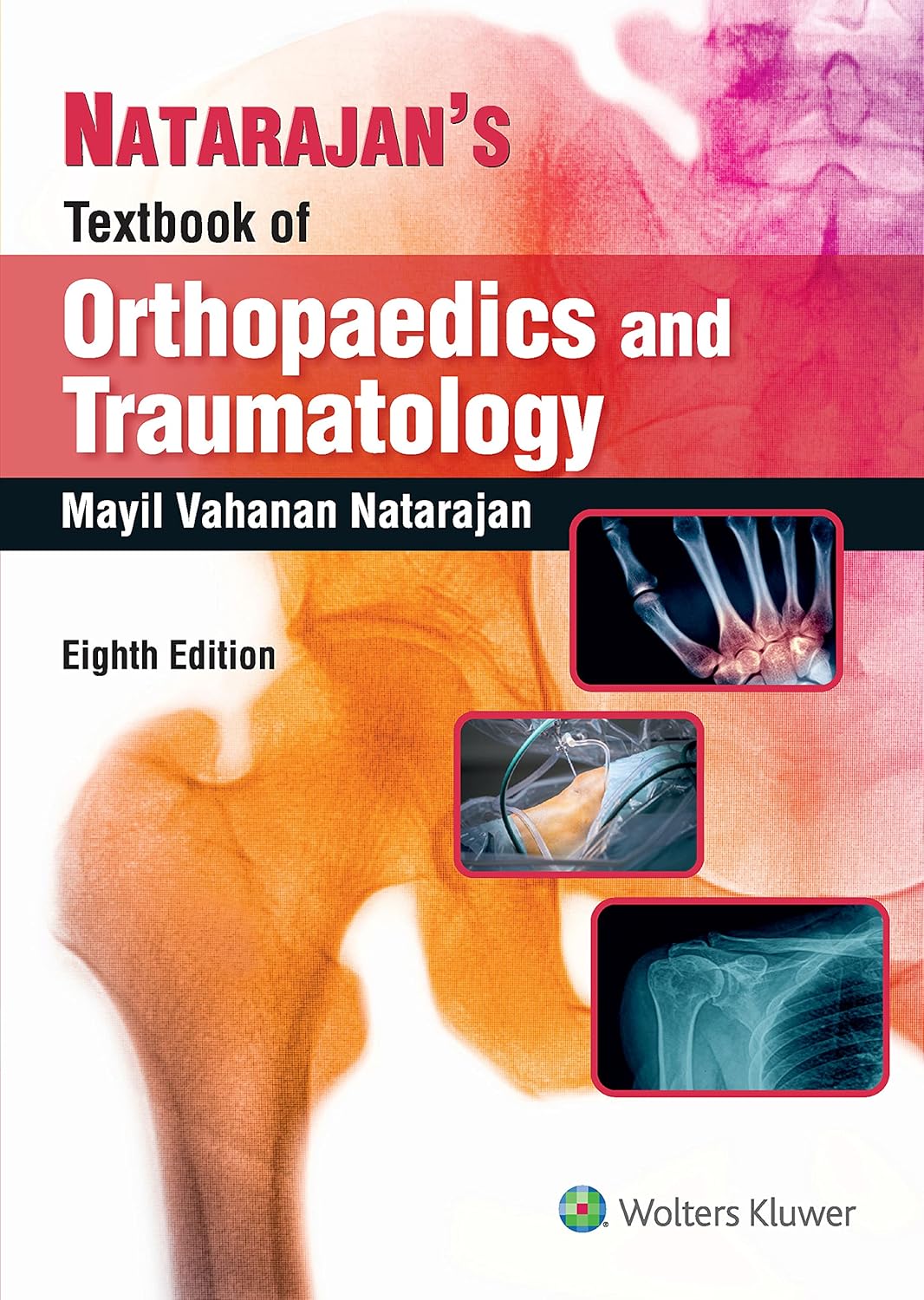 Natarajan’s Textbook of Orthopaedics & Traumatology, 8ed 8/e Edition, Kindle Edition by Prof. M. V. Natrajan 