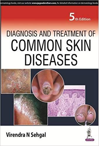 Diagnosis And Treatment Of Common Skin Diseases Paperback-25 Jun 2016by Sehgal Virendra N (Author)