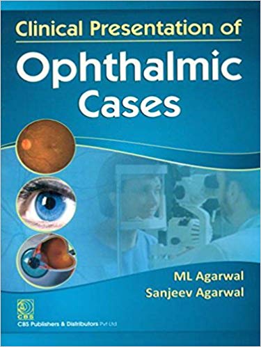 Clinical Presentation of Ophthalmic Cases Paperback-2012 by M L Agarwal (Author), Sanjeev Agarwal (Author)