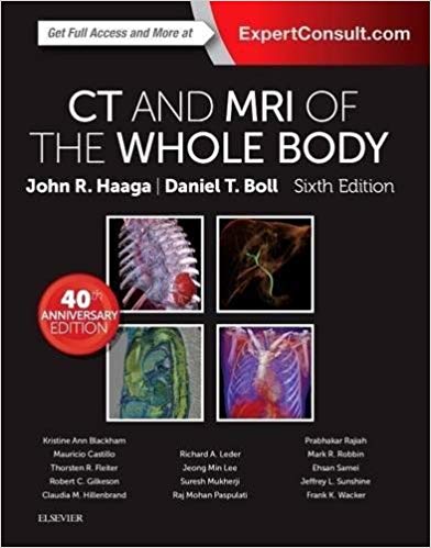 CT and MRI of the Whole Body, 2-Volume Set Hardcover-2 Aug 2016by John R. Haaga MD FACR FSIR FSCBT FSRS (Author), Daniel Boll MD FSCBT (Author)